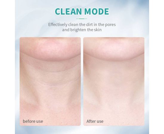 ANLAN Neck Face Beauty Device 3 Colors LED Photon Therapy Skin Tighten Reduce Double Chin Anti Wrinkle Remove Skin Care Tools