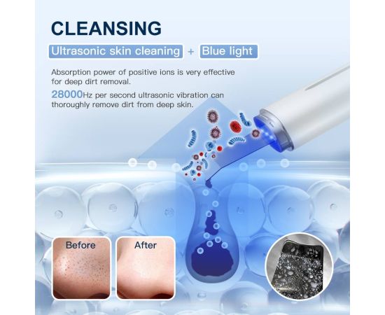 ANLAN Ultrasonic Skin Scrubber IXP5 Waterproof Low Noise Light Therapy EMS Face Lifting Ultrasonic Face Cleaner Peeling Machine